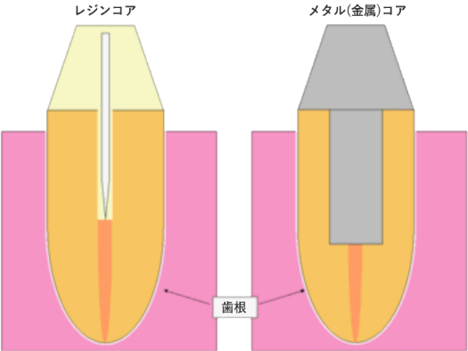 歯の土台から美しくするには